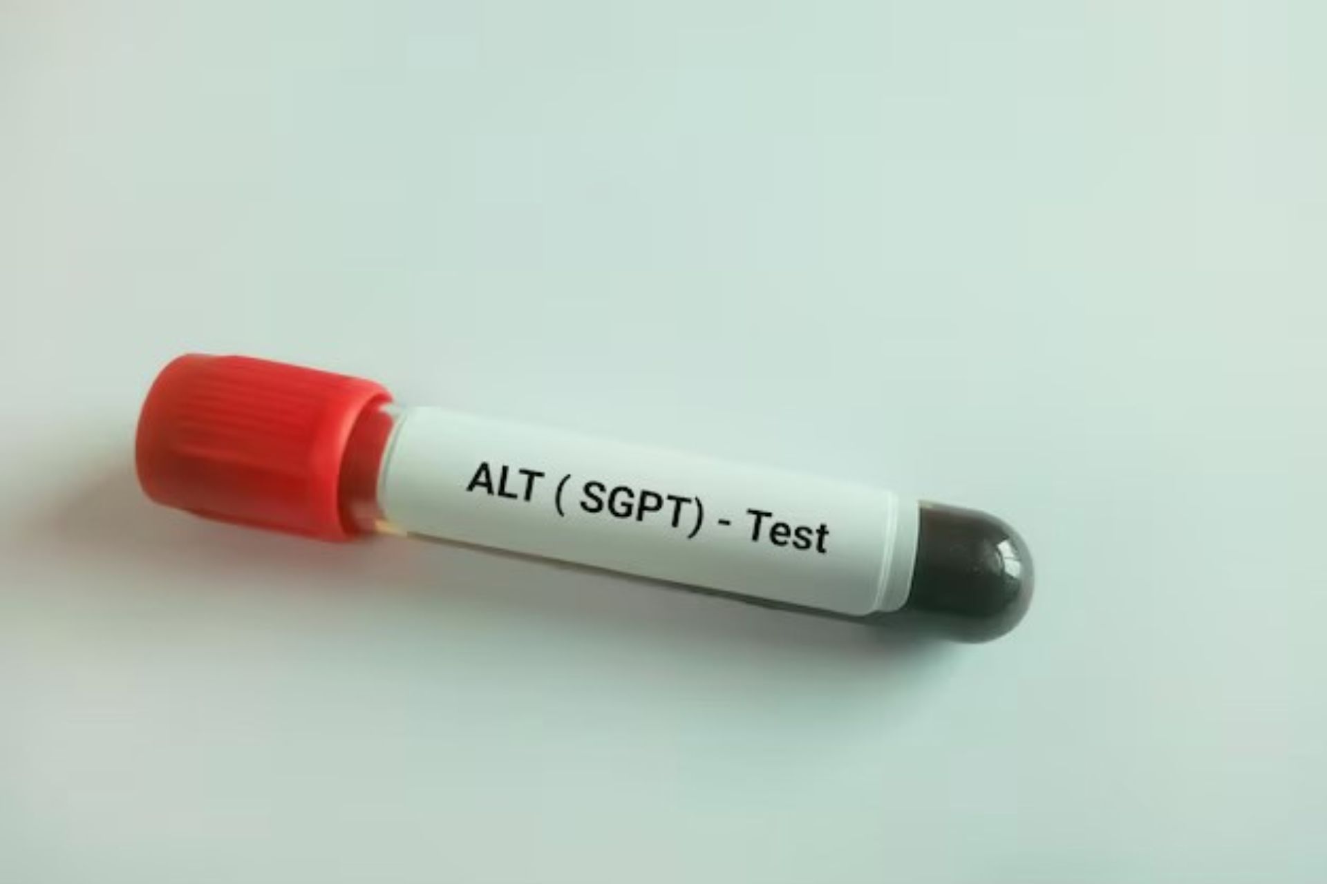 SGPT test price in Bangladesh